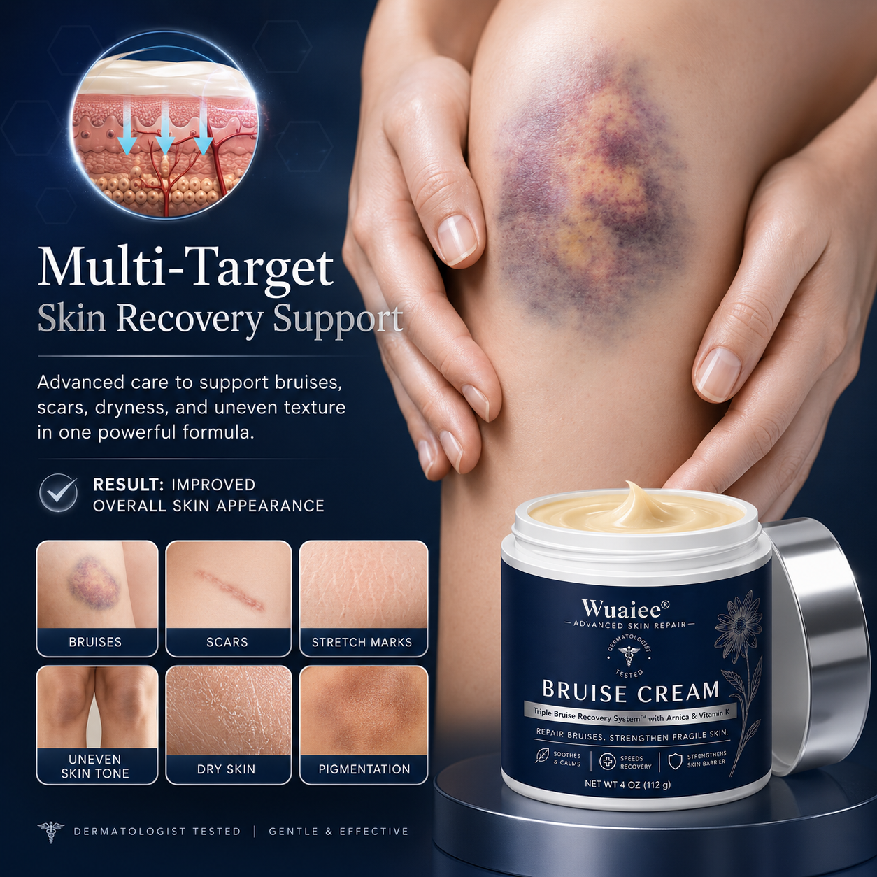 💥100K+ SOLD💕- Wuaiee® Bruise Repair & Skin-Strengthening Cream