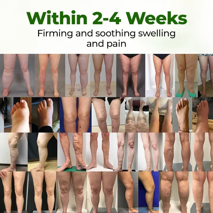 Wuaiee® Professional Leg Circulation Cream