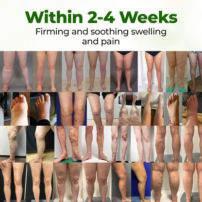 Wuaiee® Professional Leg Circulation Cream